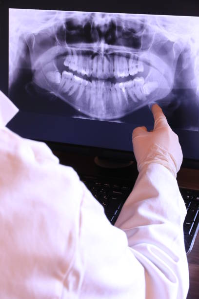 Best Emergency Dental Services for Seniors in Solvang, CA